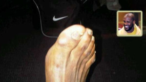 Does Shaq Have Pretty Feet? [PIC]
