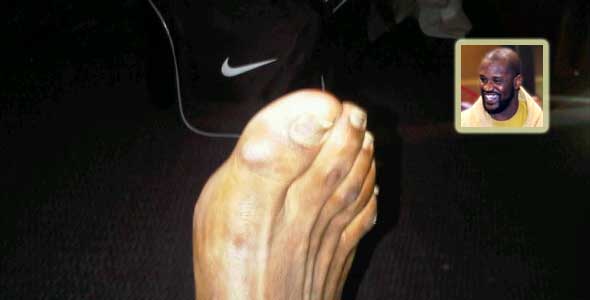 Does Shaq Have Pretty Feet? [PIC]