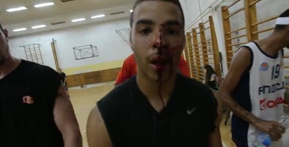 Oregon State Player Shatters Backboard, Gets 20 Stiches